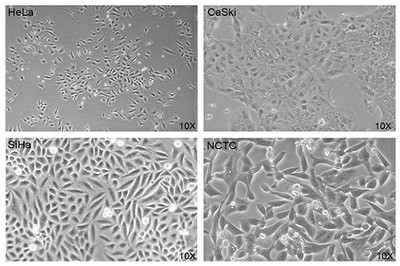 Linee cellulari di cheratinociti