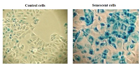 Senescence assay