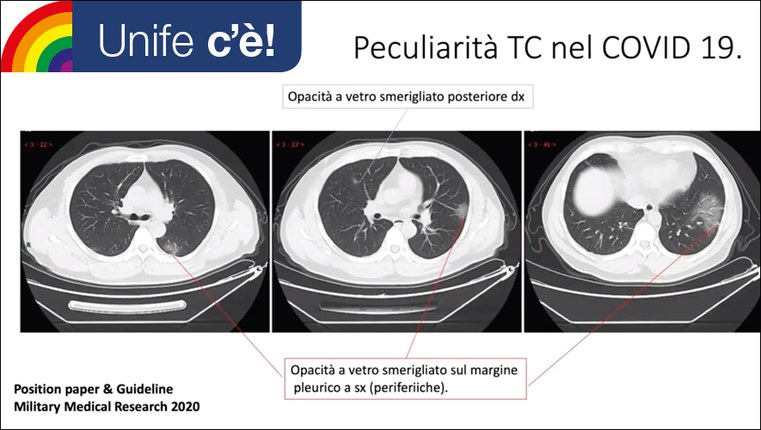 Polmonite da Covid19 | Un video tutorial sullo screening ecografico Polmonite da Covid19 | Un video tutorial sullo screening ecografico