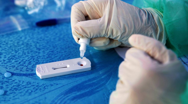 Regione Emilia-Romagna | Test sierologici rapidi per studentesse e studenti in farmacia