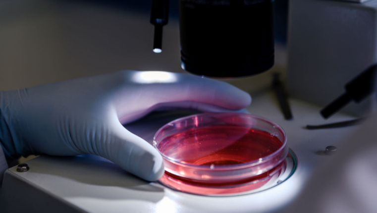 Diagnostica | Con il progetto BiophotOmics la diagnosi passa da una goccia di sangue