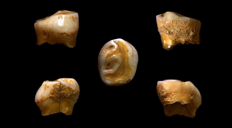 Archeogenetica | Batteri orali e carboidrati, una sorpresa per la nostra storia evolutiva