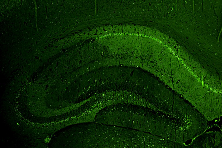epilessia
