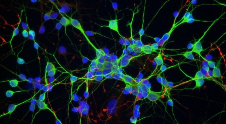 Epilessia | Cellule ingegnerizzate come micro-software per prevedere e bloccare le crisi epilettiche