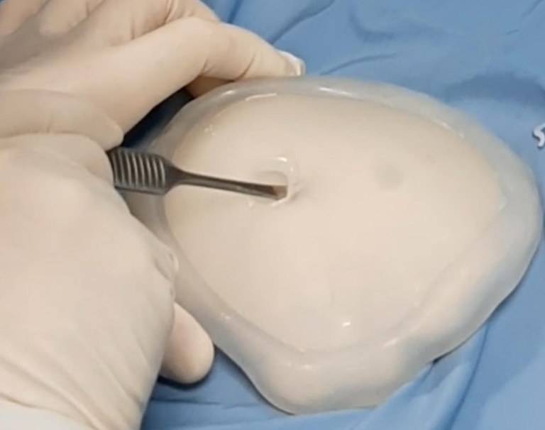 protesi PL tech.jpeg