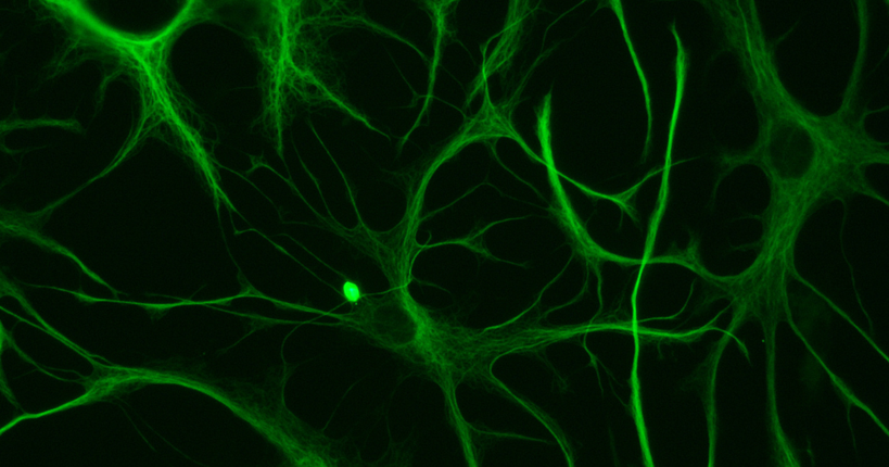 Cervello e funzioni cognitive | Studio a partecipazione Unife fa luce sul ruolo degli astrociti