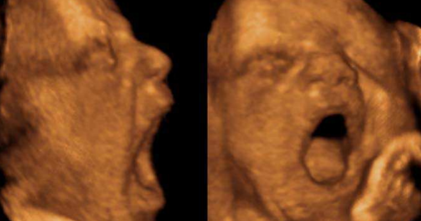 Gravidanza e sbadiglio | Studio Unife apre nuove prospettive sul comportamento prenatale