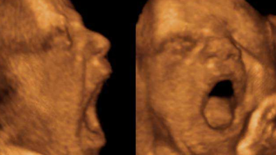 Gravidanza e sbadiglio | Studio Unife apre nuove prospettive sul comportamento prenatale