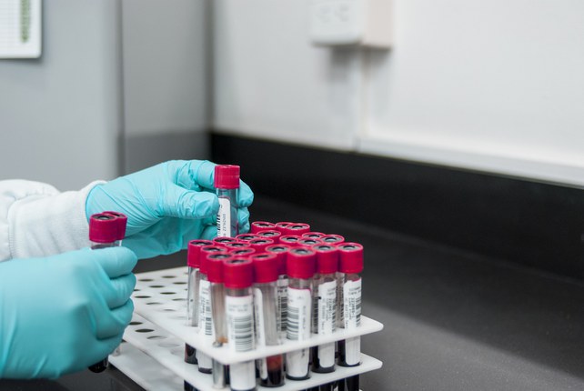 Diagnosi del cancro | Unife nel team europeo che studia test non invasivi dall'analisi del sangue