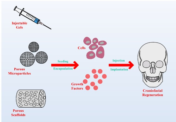 Reconstruction of craniomaxillofacial bone