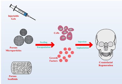 Reconstruction of craniomaxillofacial bone